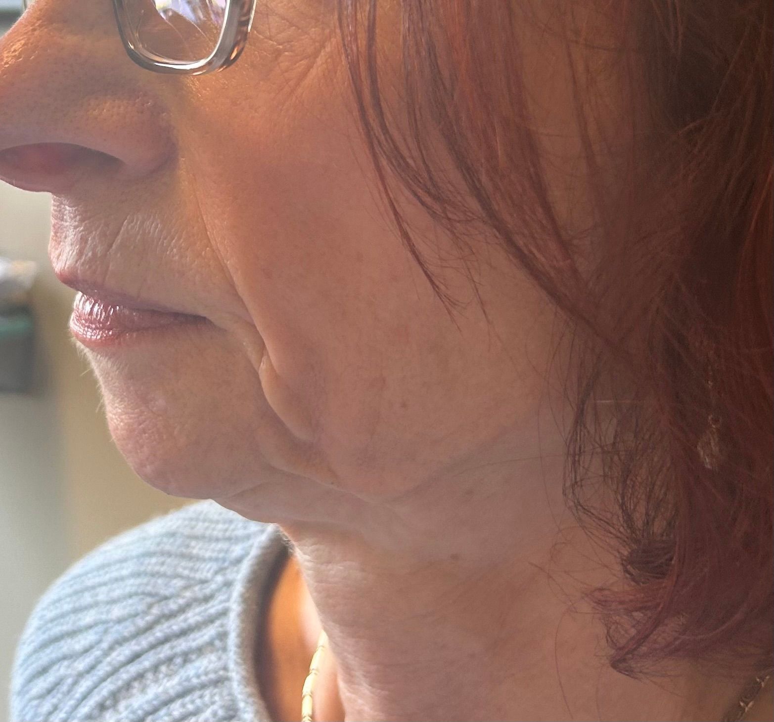 Profile of a person with eyeglasses, showing the side of their face and neck with wrinkles.
