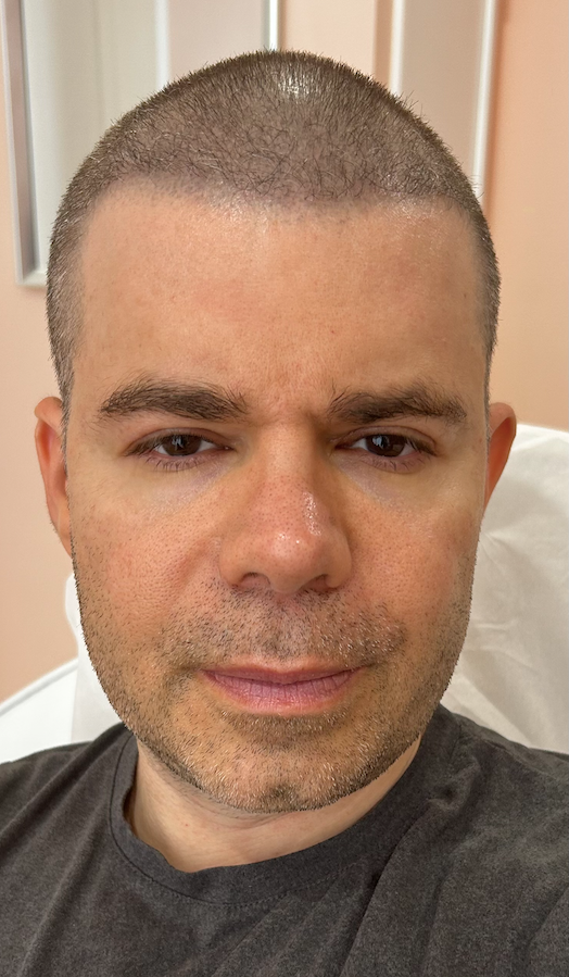 Man with short brown hair, looking at the camera with a neutral expression. Wearing a dark gray shirt. Light pink wall in background.