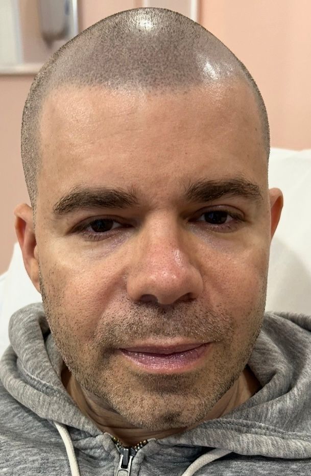 Man with shaved head looking forward, wearing a gray hoodie.