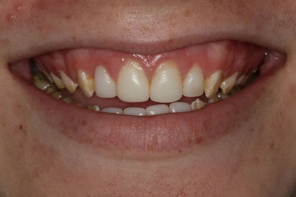 A close up of a person 's mouth with white teeth.