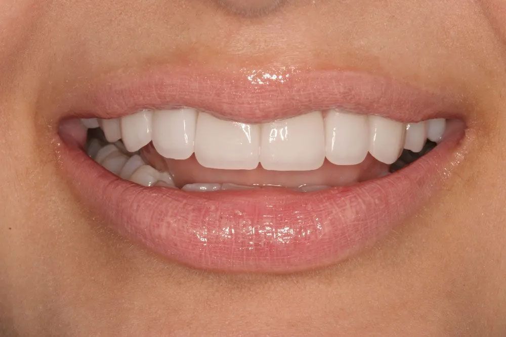 A close up of a woman 's mouth with white teeth.