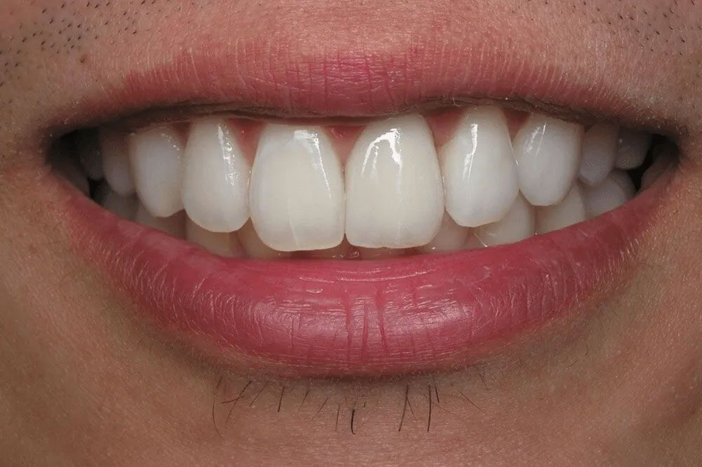 A close up of a man 's mouth with white teeth and red lips.