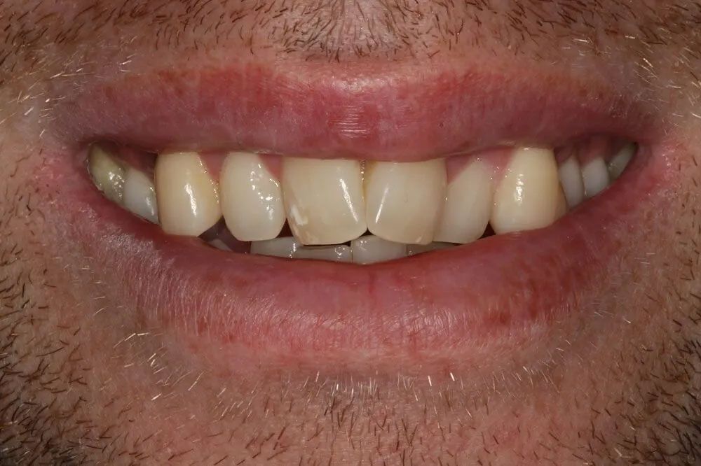 A close up of a man 's mouth with a beard and teeth.