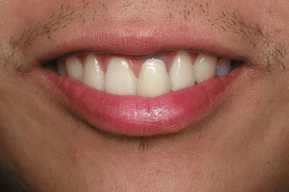 A close up of a man 's mouth with white teeth and red lips.