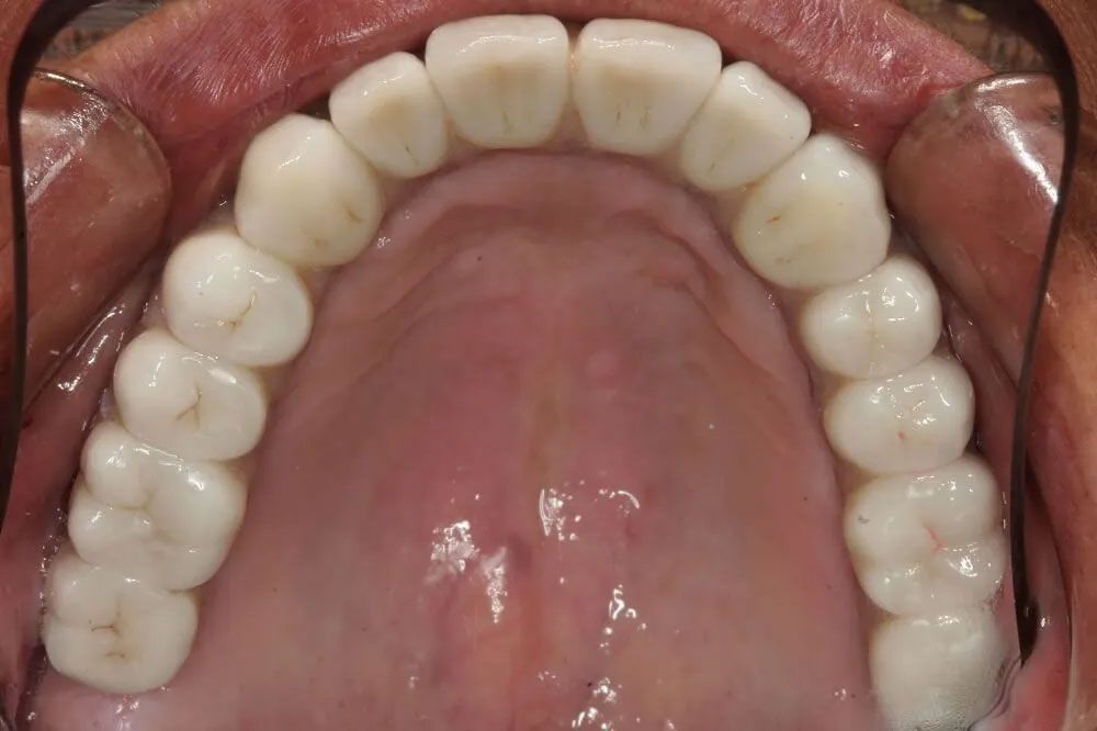 A close up of a person 's mouth with white teeth.