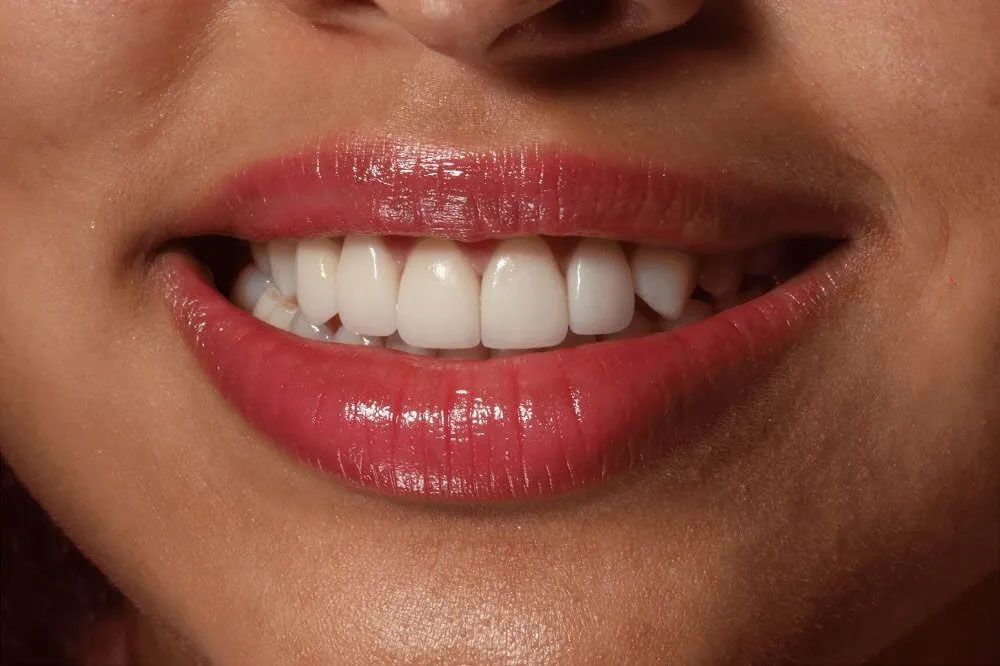 A close up of a woman 's mouth with white teeth and red lipstick.