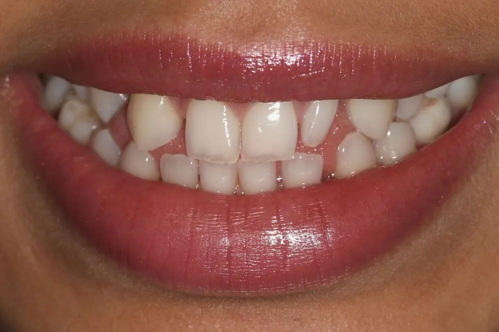 A close up of a woman 's mouth with white teeth and red lips.