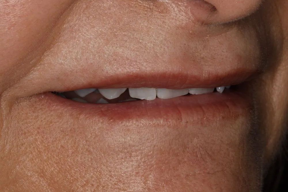 A close up of a woman 's mouth with white teeth.