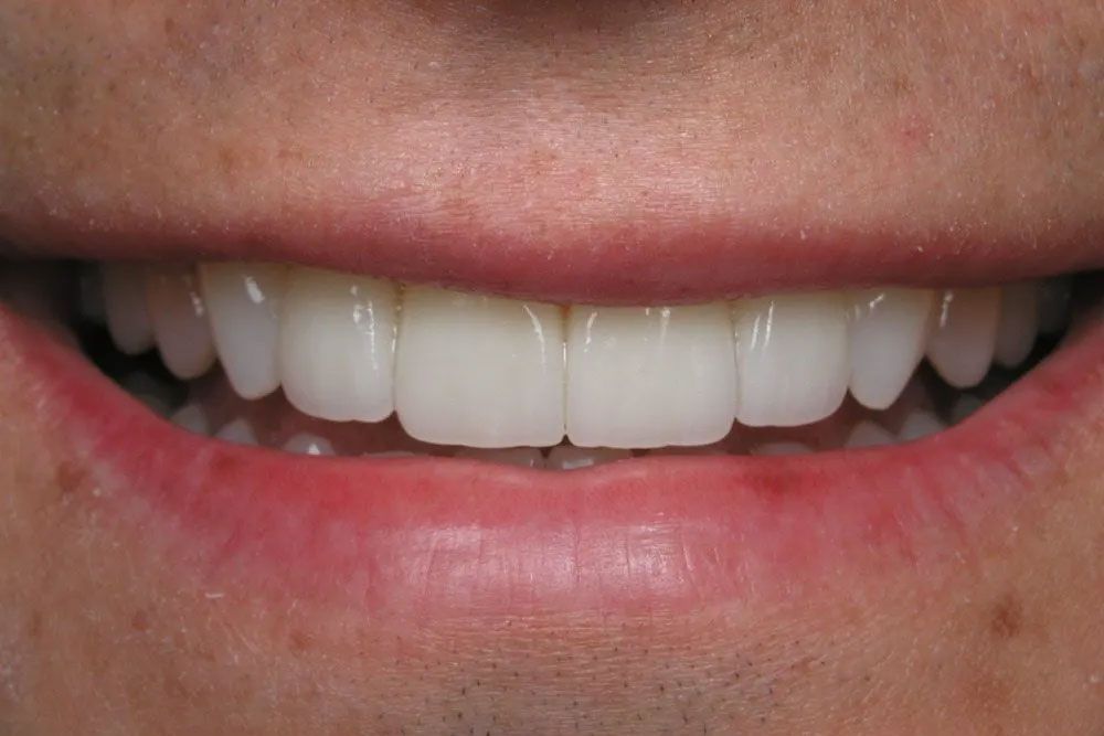 A close up of a person 's smile with white teeth and red lips.