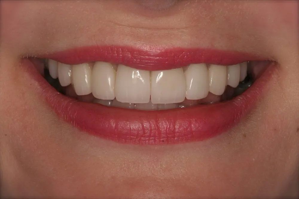 A close up of a woman 's smile with white teeth and red lipstick.