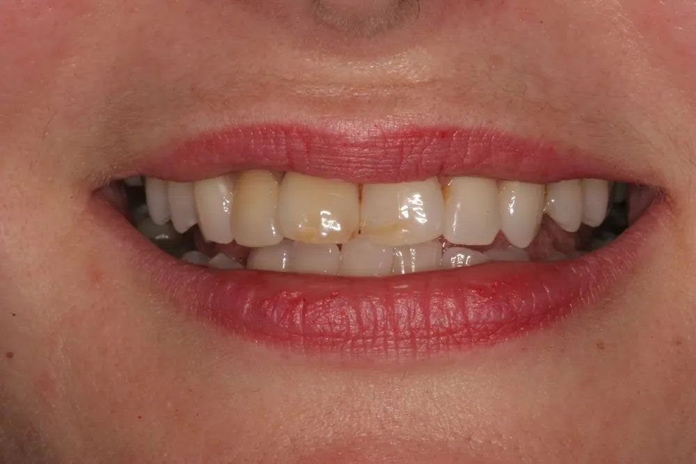 A close up of a woman 's mouth with white teeth and red lips.