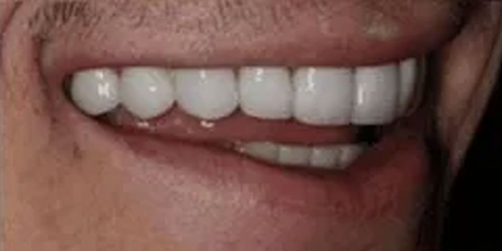A close up of a man 's mouth with white teeth.