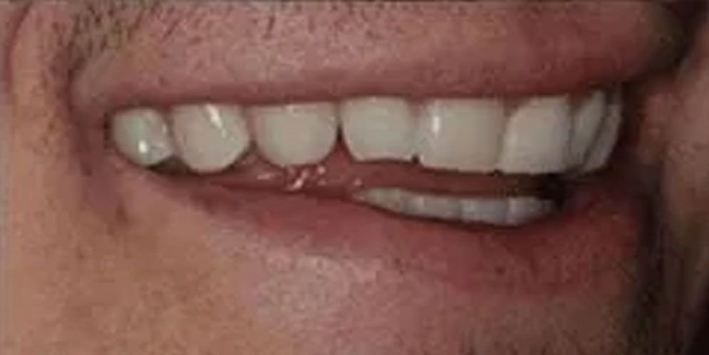 A close up of a man 's mouth with white teeth.