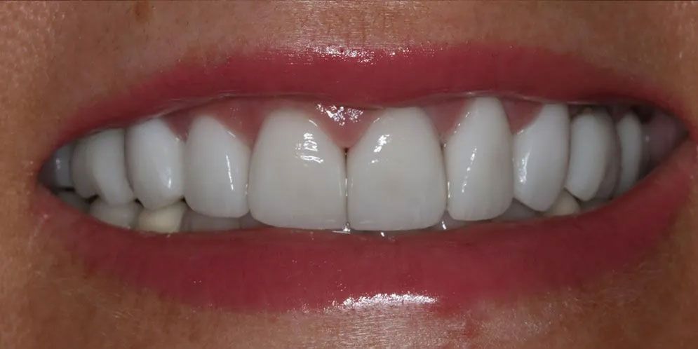 A close up of a woman 's mouth with white teeth and red lips.