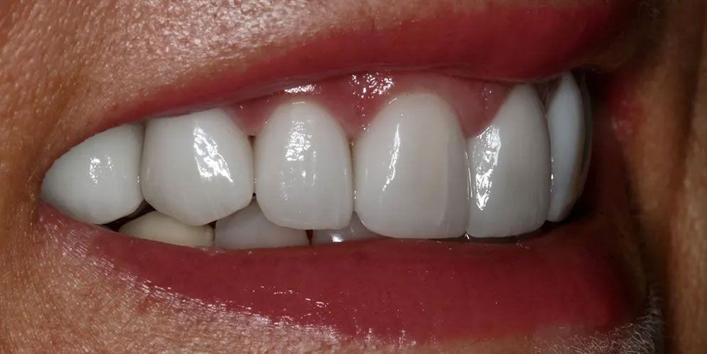 A close up of a woman 's mouth with white teeth and red lips.