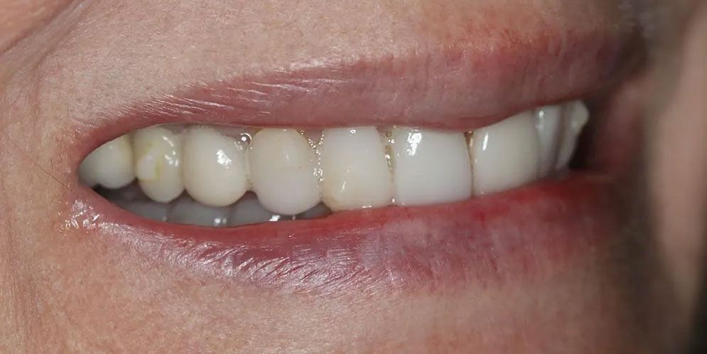 A close up of a woman 's mouth with white teeth.
