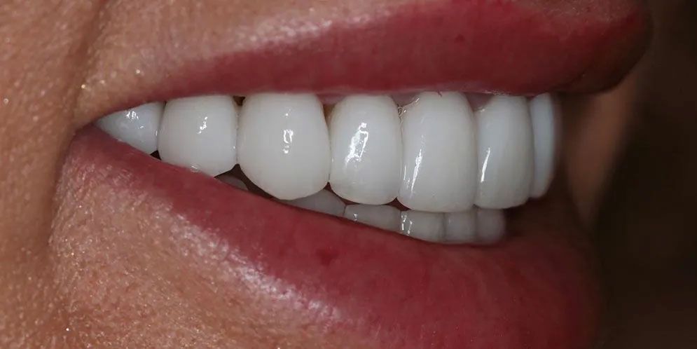 A close up of a woman 's mouth with white teeth and red lips.