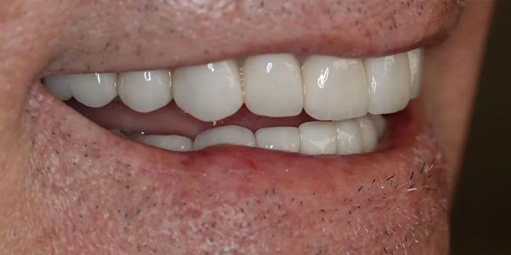 A close up of a man 's mouth with white teeth.