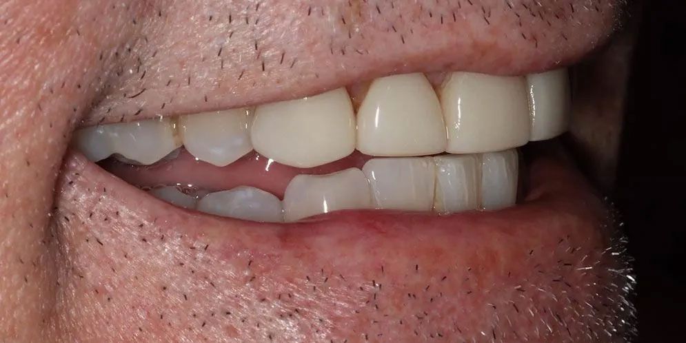 A close up of a man 's mouth with white teeth.