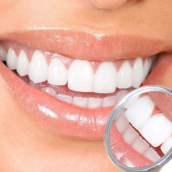 A woman 's teeth are being examined by a dental mirror