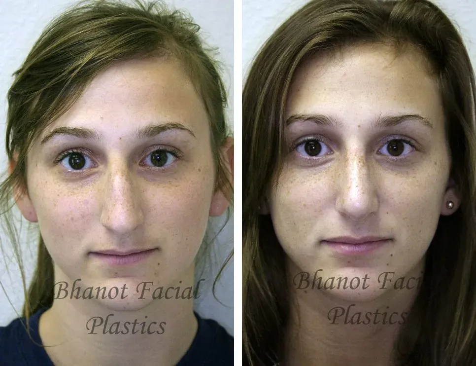 Plastic surgery