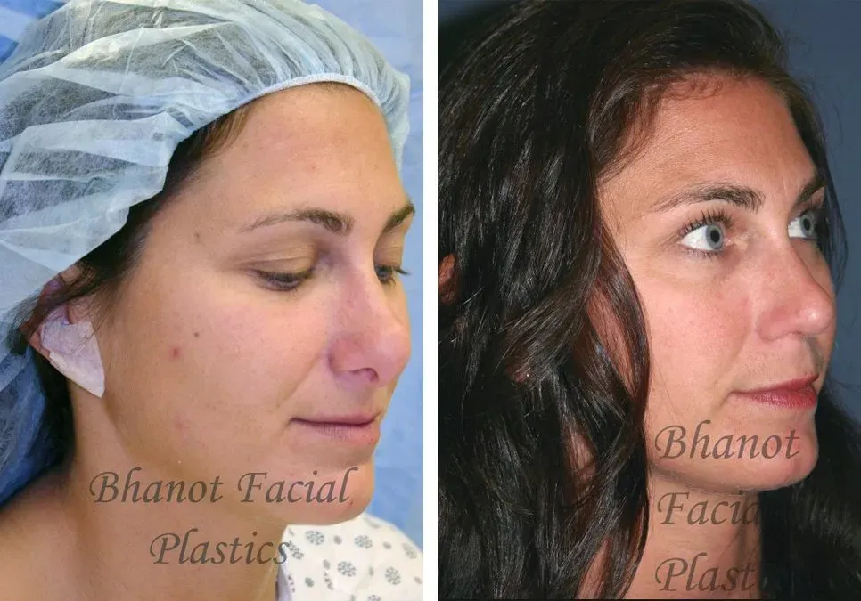 Plastic surgery