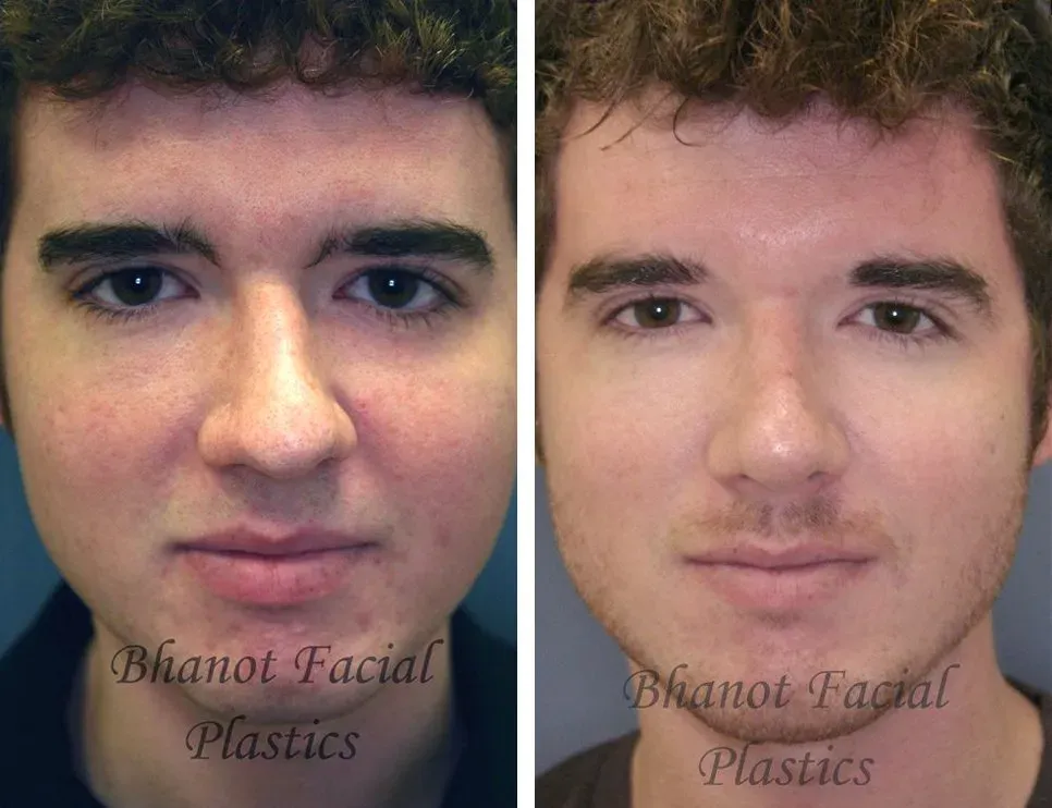 Plastic surgery