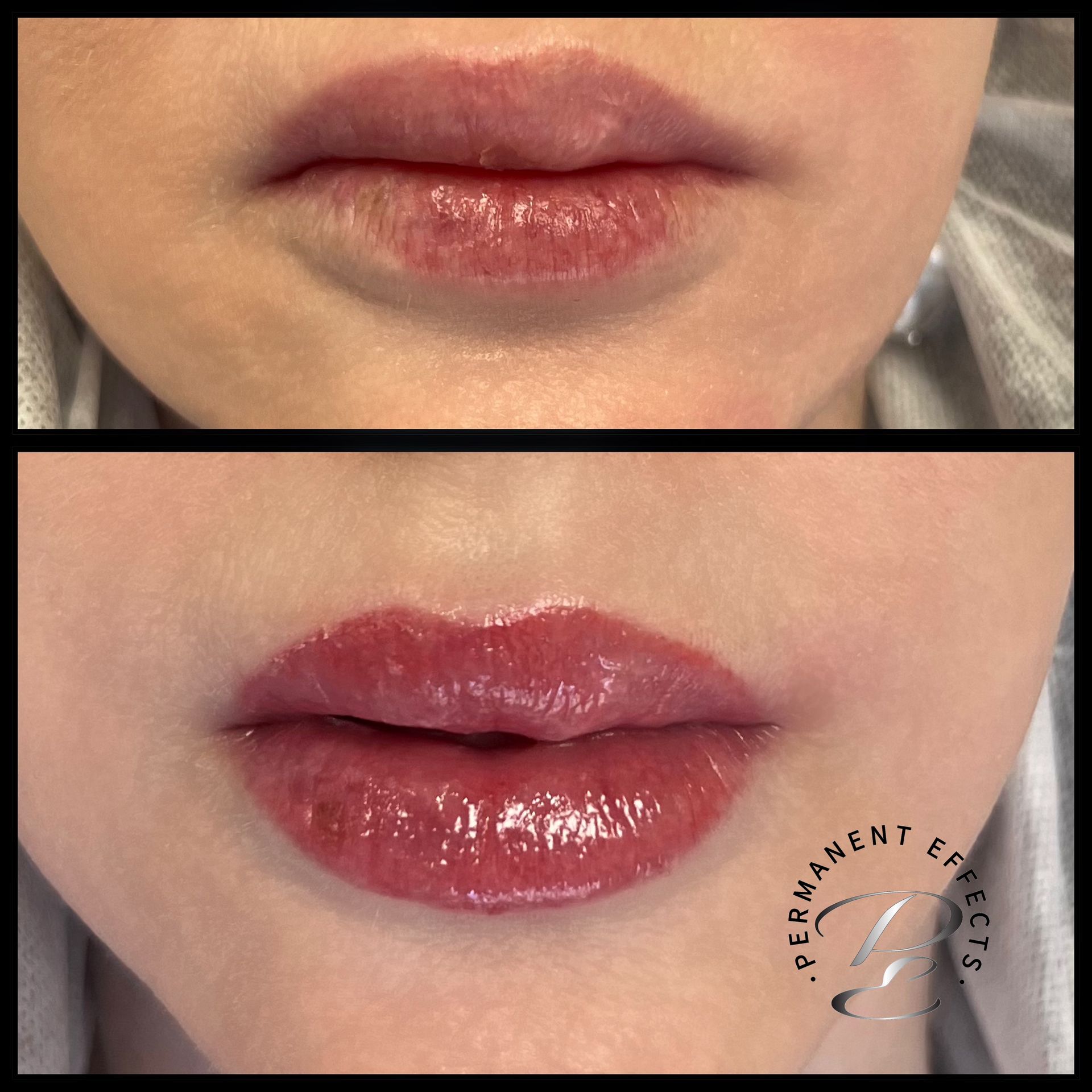 Before-and-after of lips, top, natural lips; bottom, fuller lips with lip color.