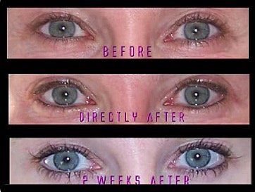 A before and after picture of a woman's eyes