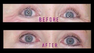 A before and after picture of a woman's eyes.