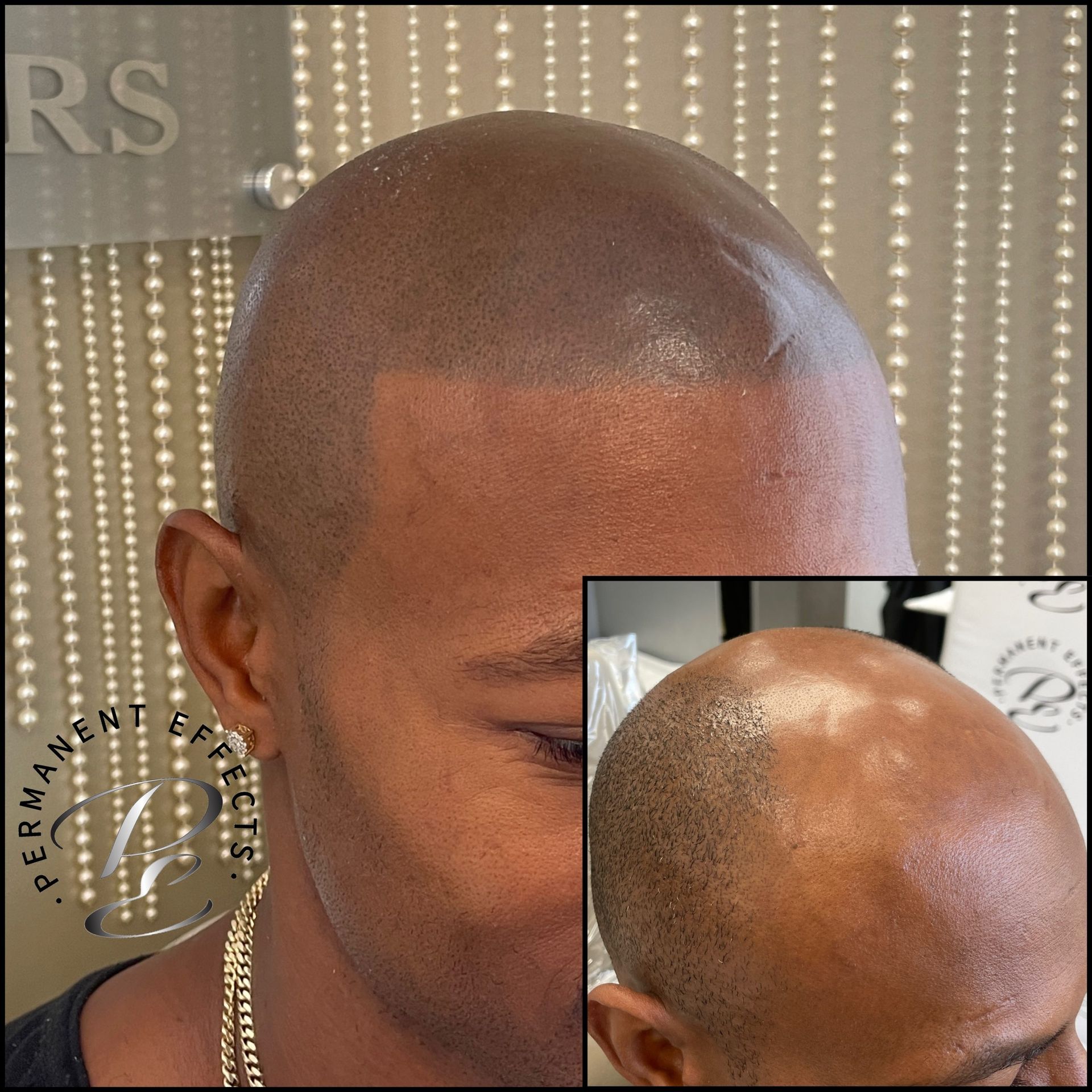 A man with a shaved head has a tattoo on his forehead that says rs