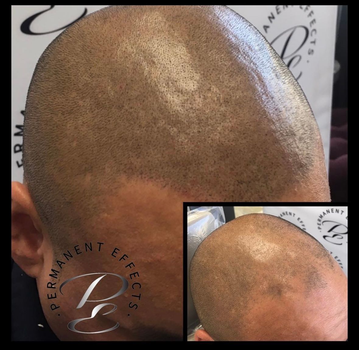 A close up of a man 's head with permanent effects written around it