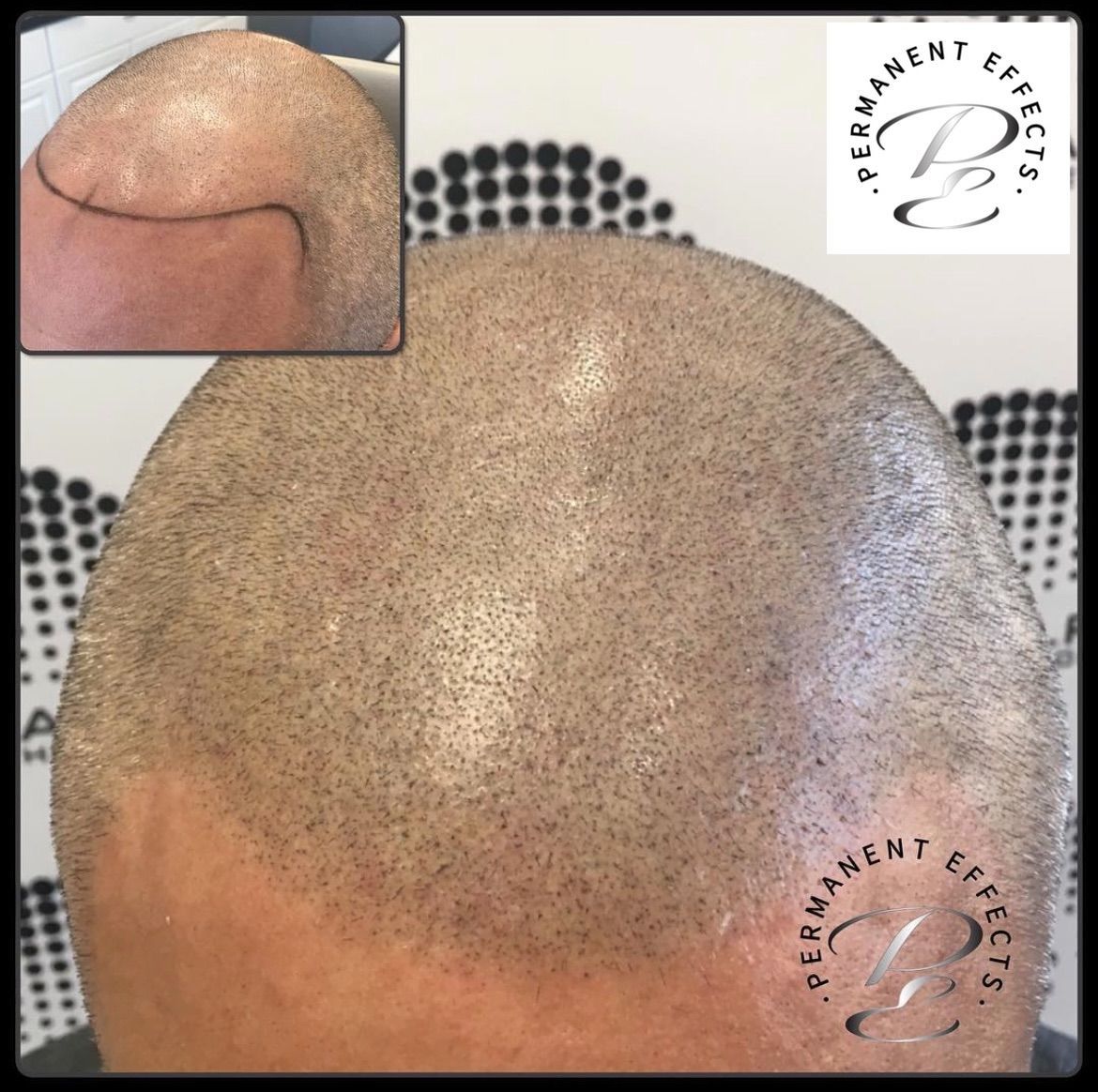 A close up of a man 's head with a tattoo on it.