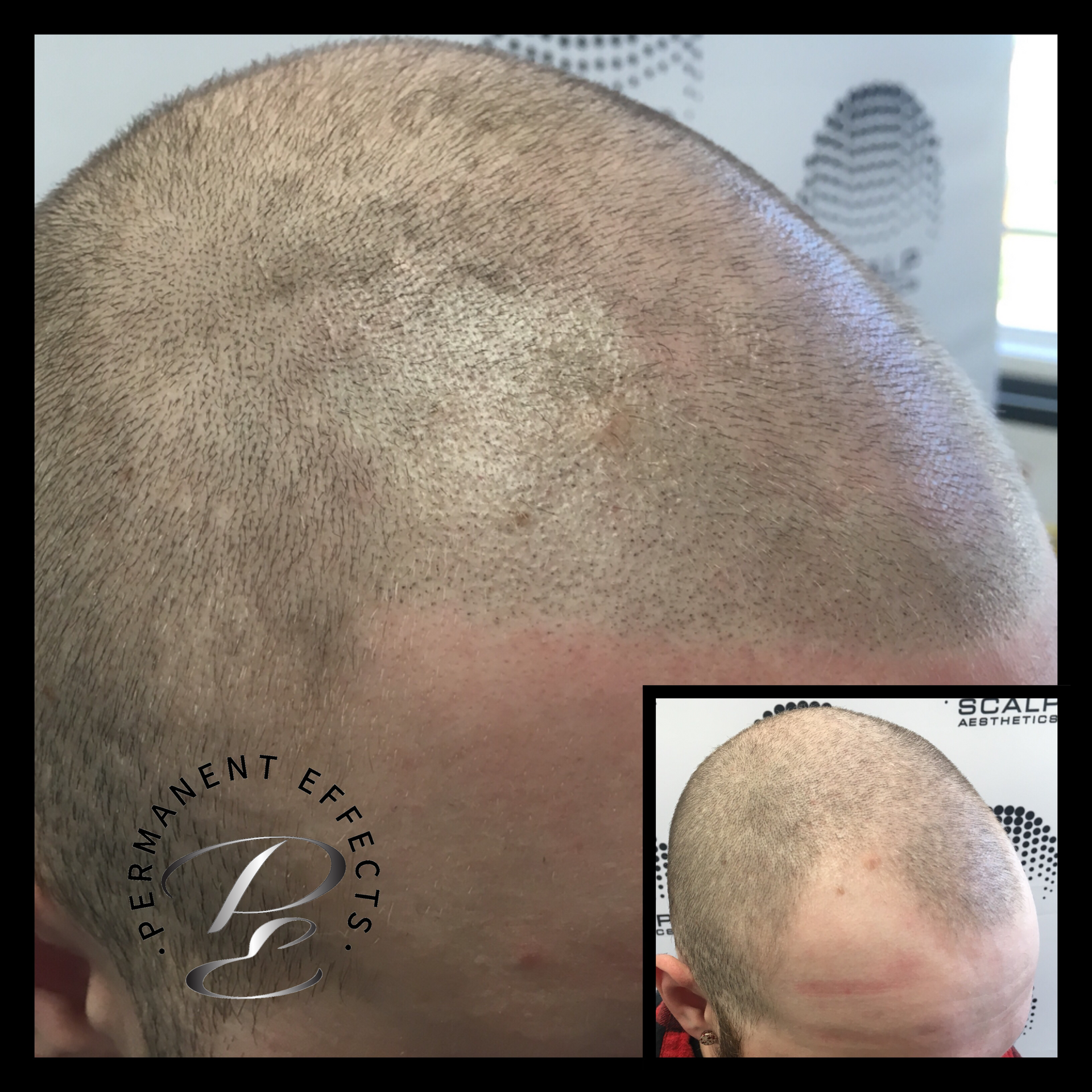 A picture of a man 's head before and after permanent effects