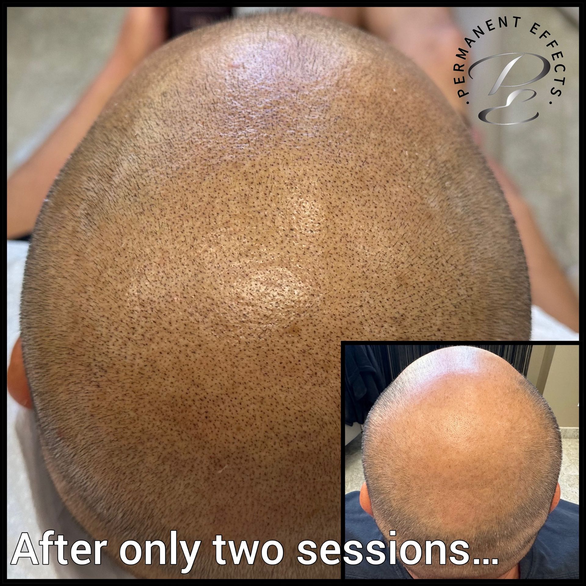 A picture of a man 's head with the words after only two sessions