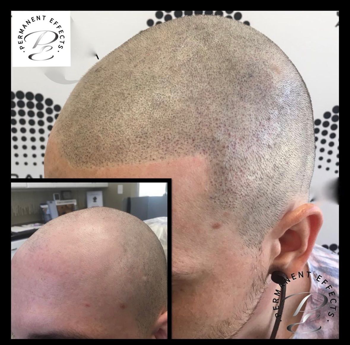 A man with a shaved head has a tattoo on his ear