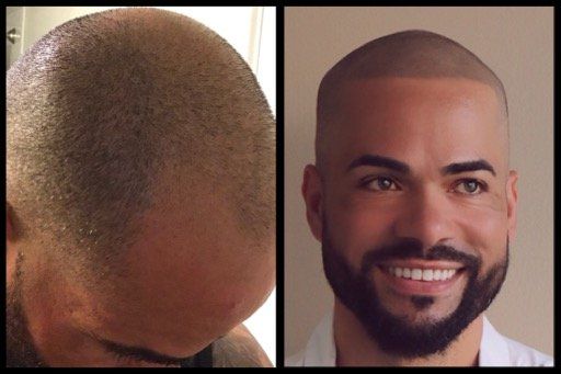 A before and after picture of a man with a beard.