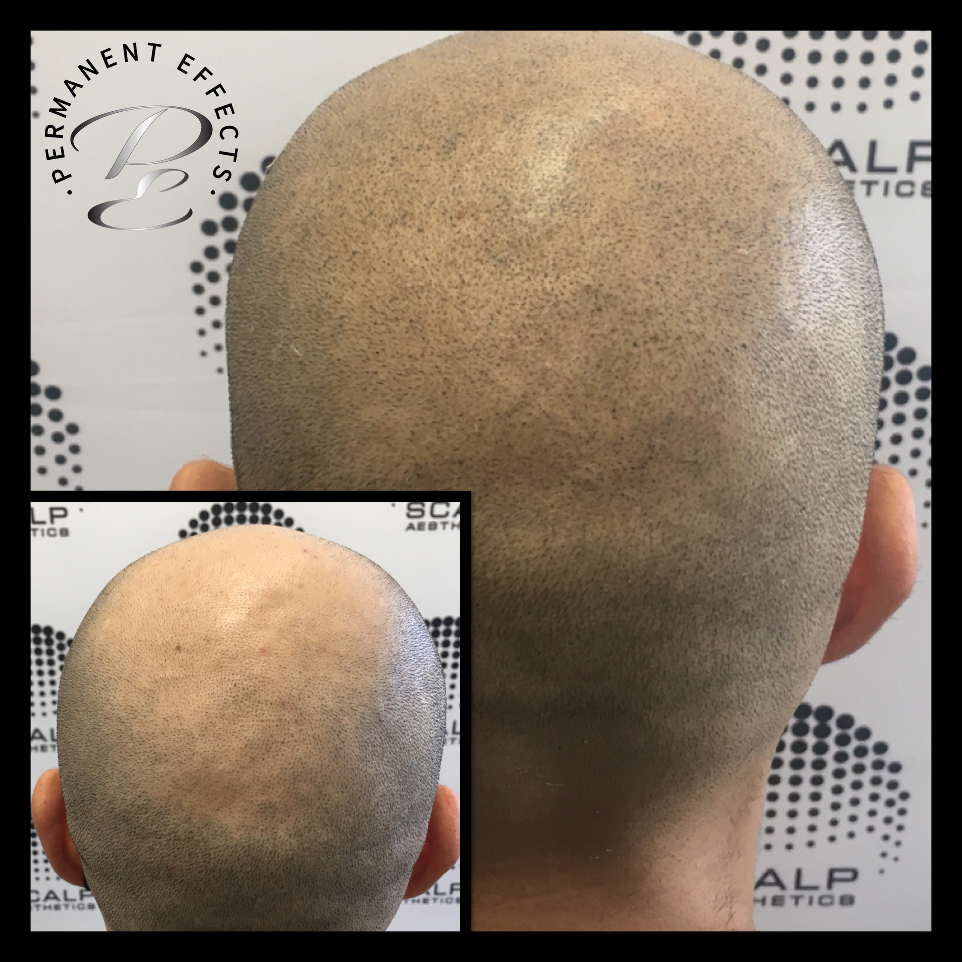 A bald man 's head is shown before and after permanent effects