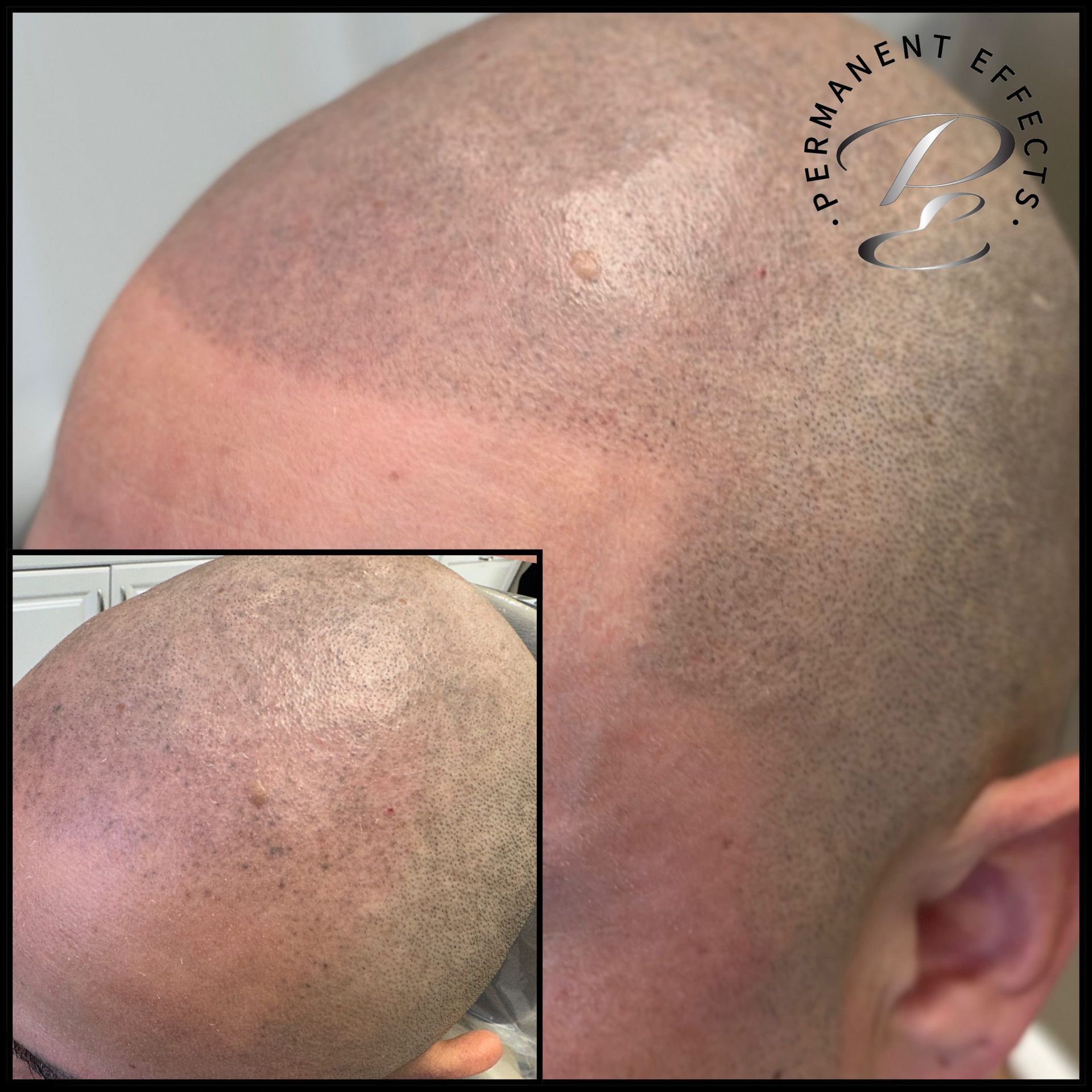 A close up of a man 's head with permanent effects written on it