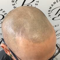 A close up of a man 's bald head with glasses.