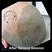 A close up of a person 's head with a tattoo on it.