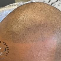 A close up of a man 's head with a tattoo on it.