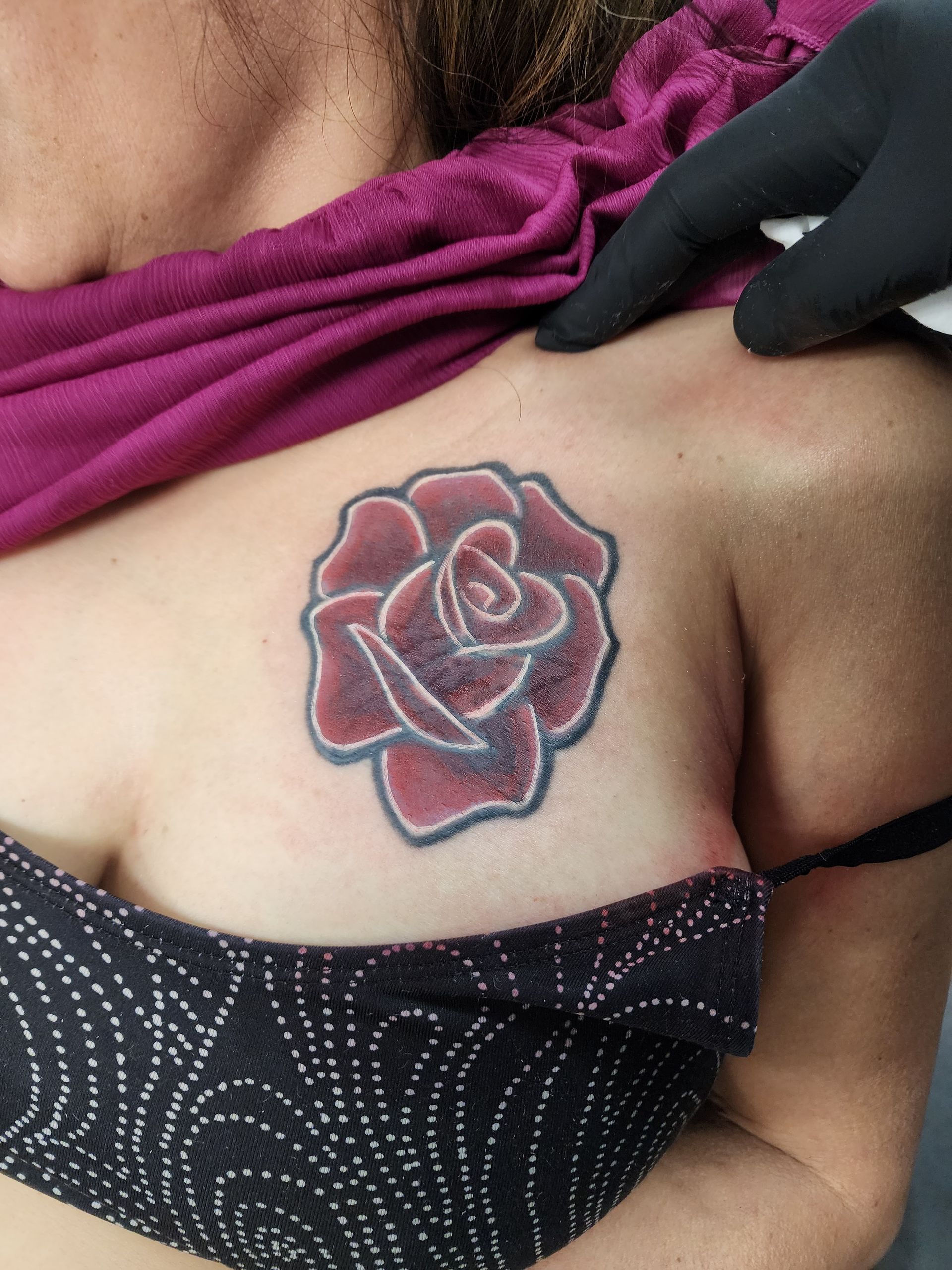 Rose tattoo on a person's chest, being examined by a gloved hand.