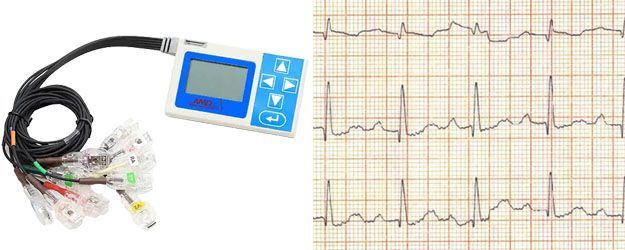 A picture of a heart monitor next to a picture of an ecg.