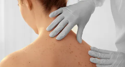 Skin Cancer Treatment