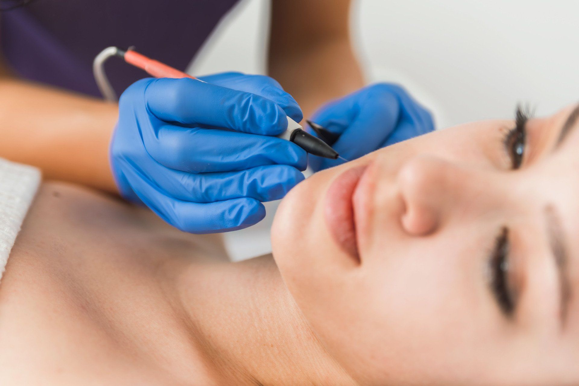 Skin Care Treatment