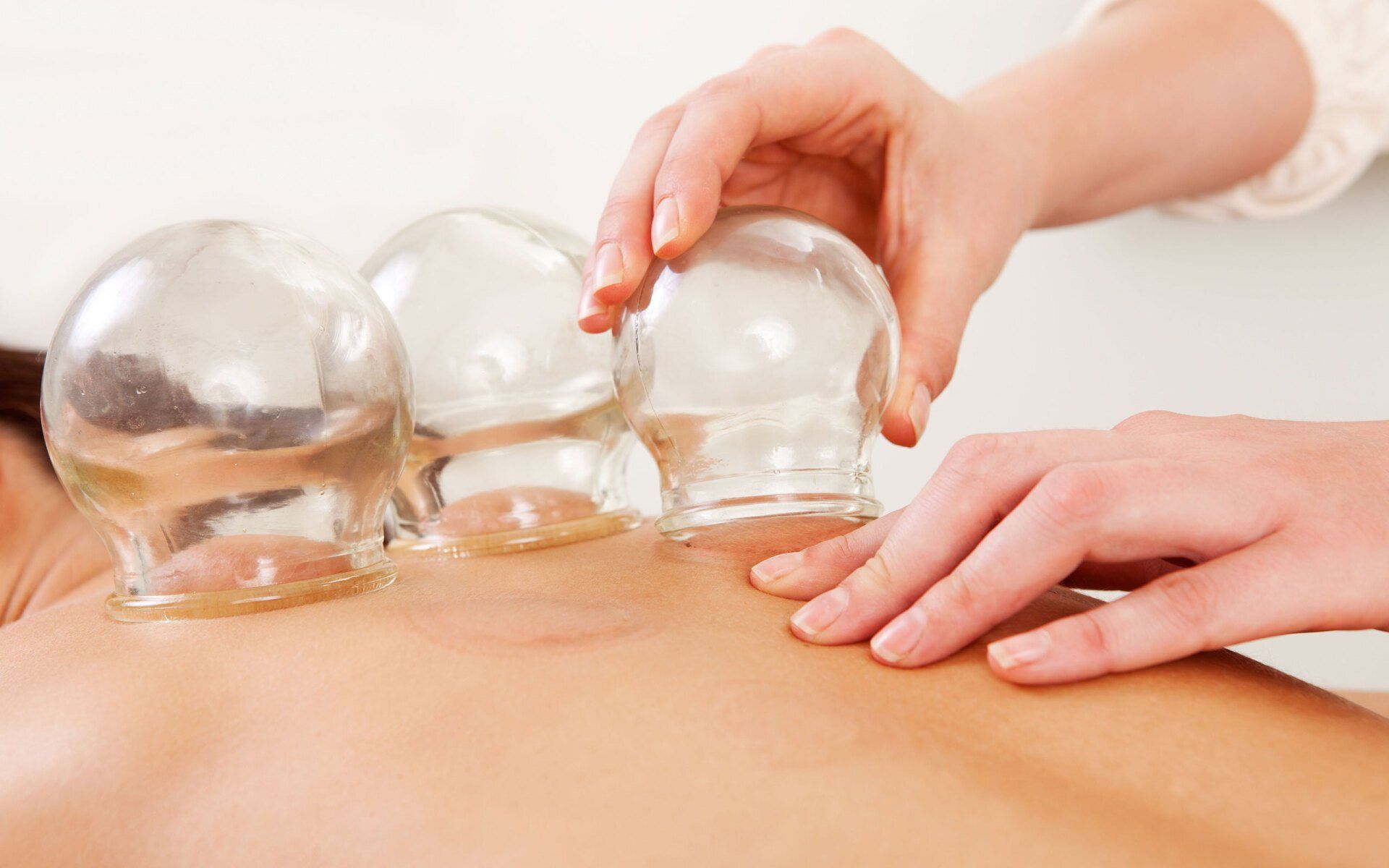 Cupping treatment