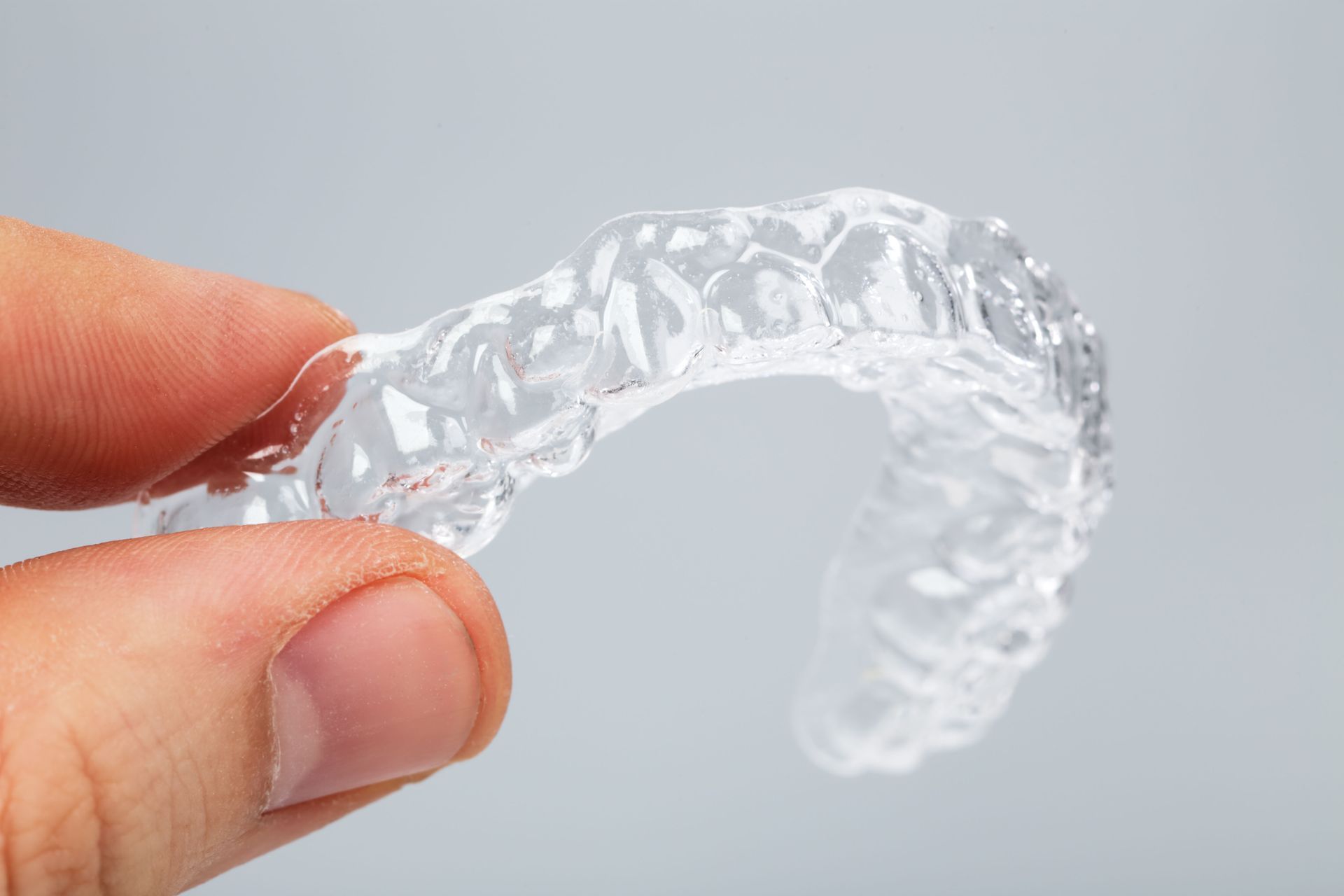 dental aligners