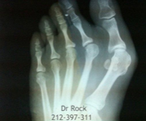 Footwork X-ray