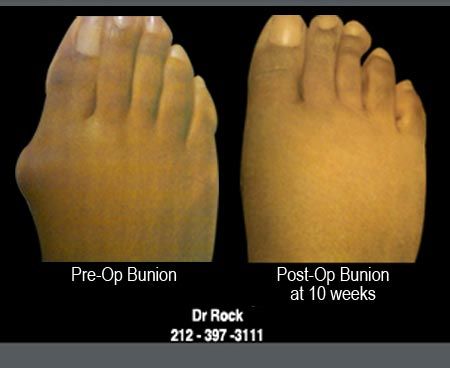 Before and after footwork